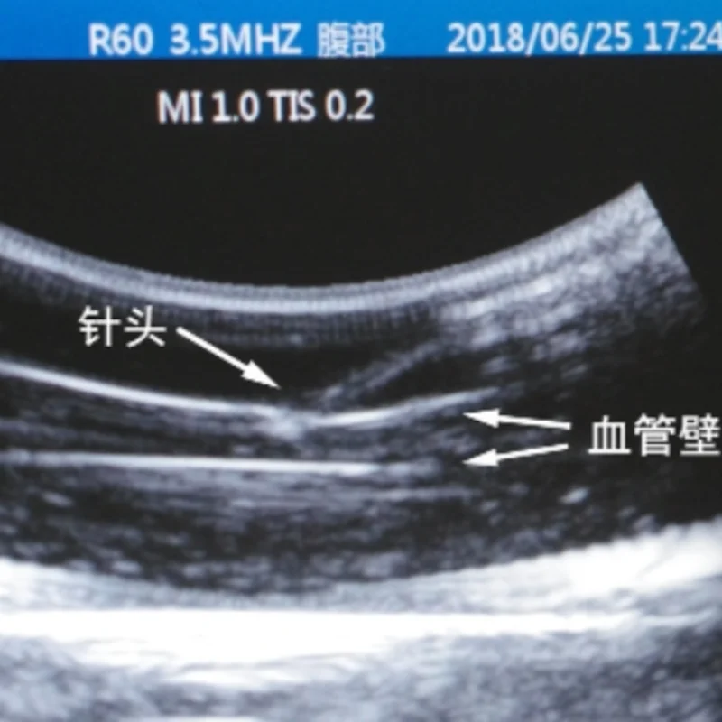 Modelo de punción vascular guiada por ultrasonido PICC B Módulo de punción de entrenamiento intervencionista por ultrasonido + bomba de circulación