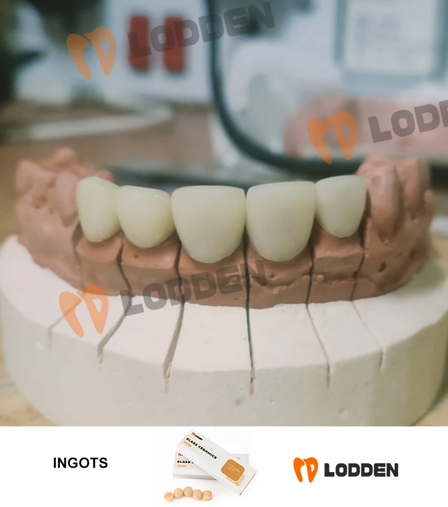 Lamden 5 pçs/set imprensa lingotes de cerâmica de vidro material de laboratório dental pressionando disilicato bloco de lítio-ht/lt