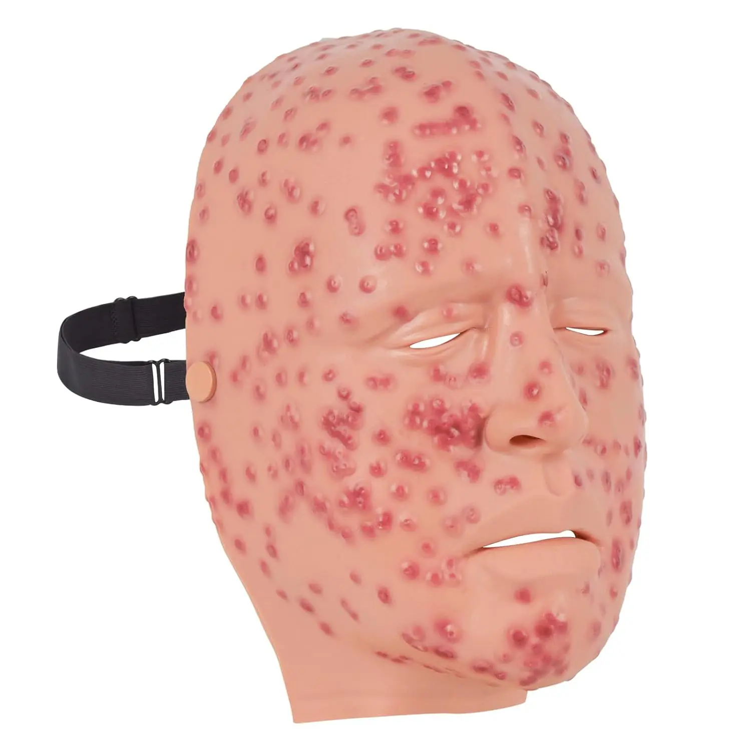 Ultrassist Facial Trauma Model Burn/Smallpox/Anthrax/Fracture/Mustard Gas Face Simulation Wounds for Military Facial Care Train - view 3