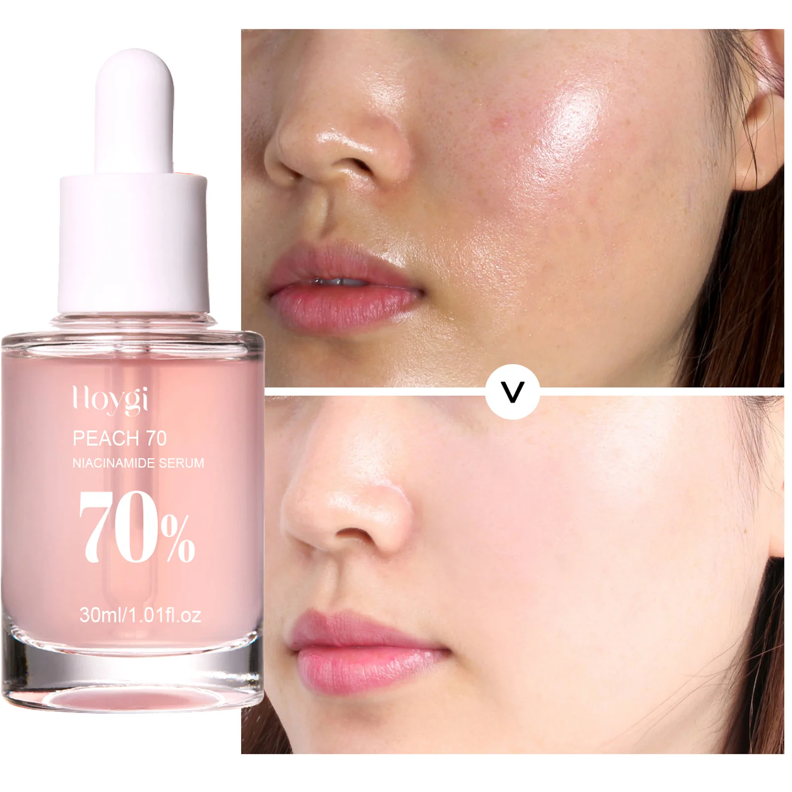 Peach 70 Niacinamide Serum Remove Dark Spots Shrink Pore Anti Acne Moisturizing Brightening Repair Smooth Soften Firm Skin Care