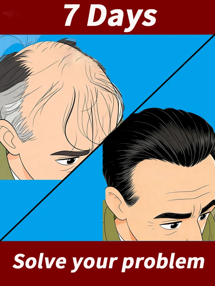 

Generation 3 Product For You To Stop Wearing Hats. Start Showing Off Free Shipping