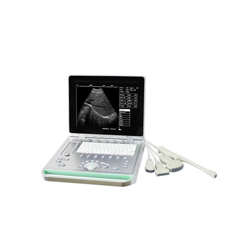 Good Image 15inch LCD Portable Medical Ultrasound Machine Laptop for gestation