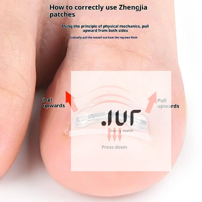 أدوات مصحح أظافر نام باديكير استعادة تضمين تو علاج الأظافر المهنية نام أظافر استقامة كليب هدفين #1