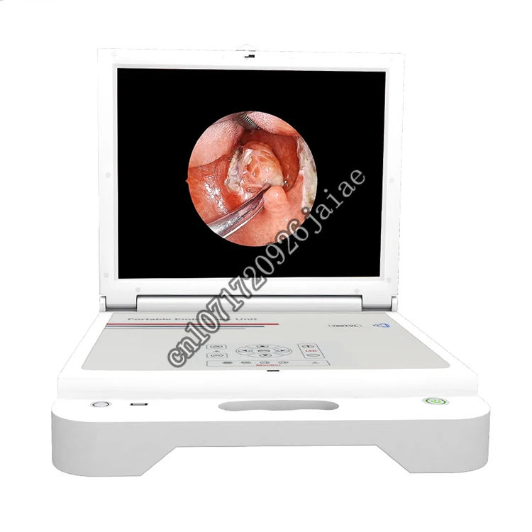 Chinese manufacturer endoscopio nasal nasoendoscope ent fibroscope complete endoscope unit