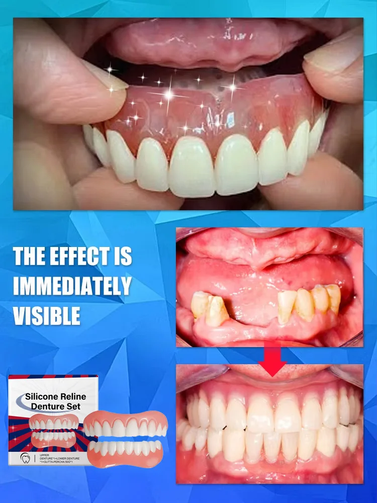 Thumbnail 3 - #68 Compare Dentures Before You Buy