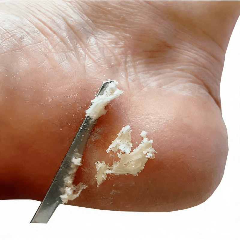 Manicure Pedicure Tool Toe Nail Shaver Feet Pedicure Knife Kit Foot Callus Rasp File Dead Skin Remover Scraper FootCar