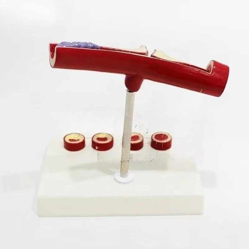 Cardiovascular model simulation teaching model, medical education