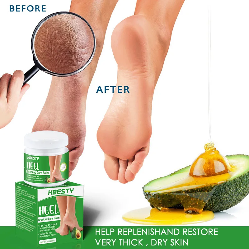 Herbal Anti Cracked Heel Treatment Cream Anti-Drying Removal Callus Dead Skin Balm Hand Foot Mositurizing Repair Skin Care Mask