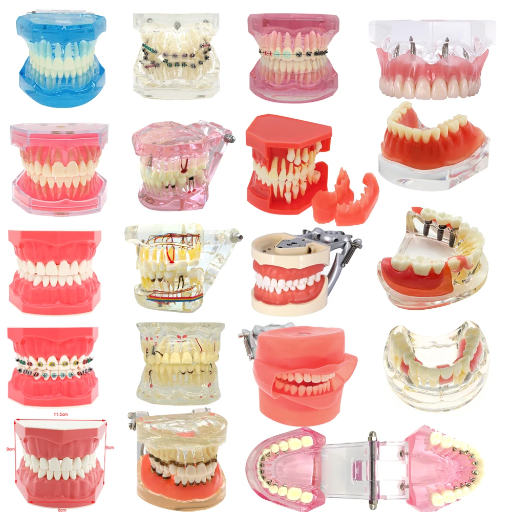 Dental Model Teeth Dental Teaching Models Implant Model Study Orthodontic Removable Teeth High Quality Dentist Material