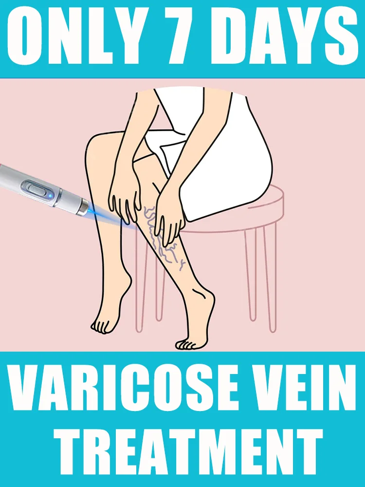 

Laser treatment for varicose veins,ᴍᴇᴅɪᴄᴀʟ grade equipment, painless treatment for spider veins and blood in the legs