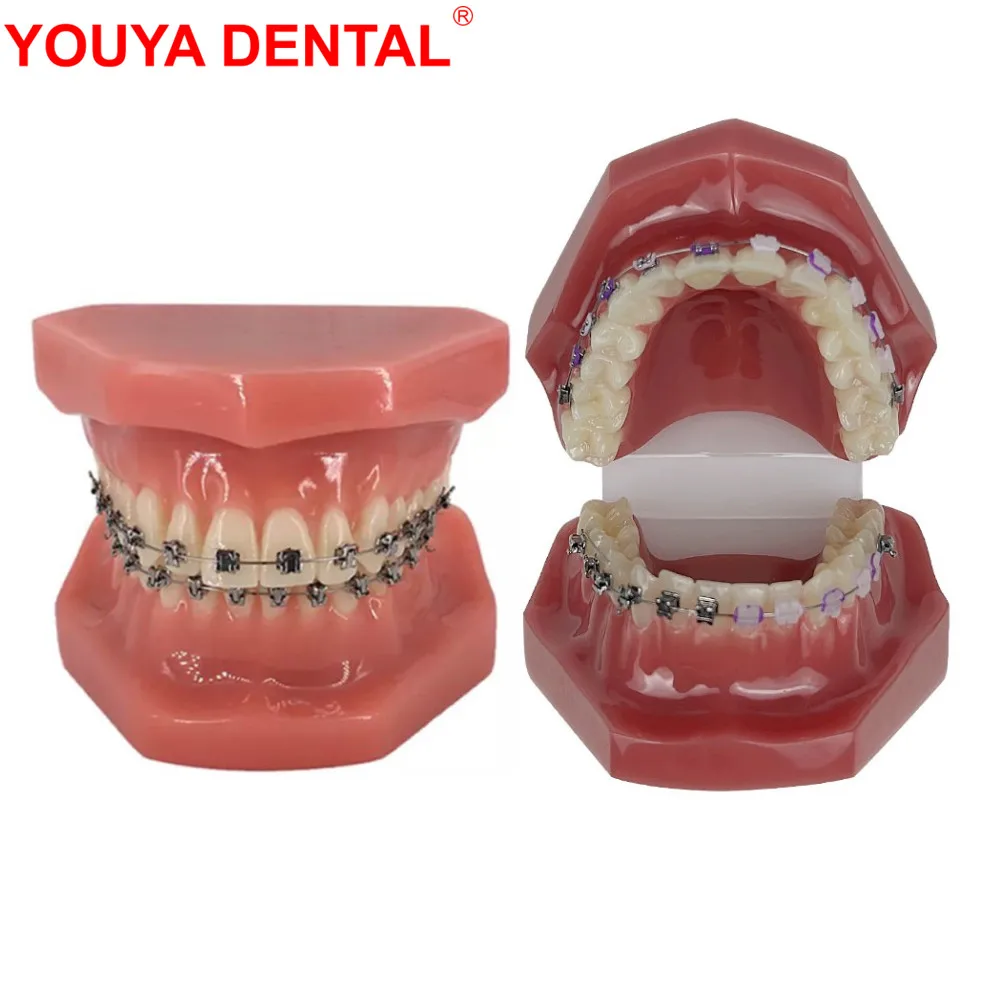 New Orthodontic Teeth Model With Braces Bracket Metal/Ceramic Self-Locking Orthodontic Dental Model Dentistry Treatment For Demo