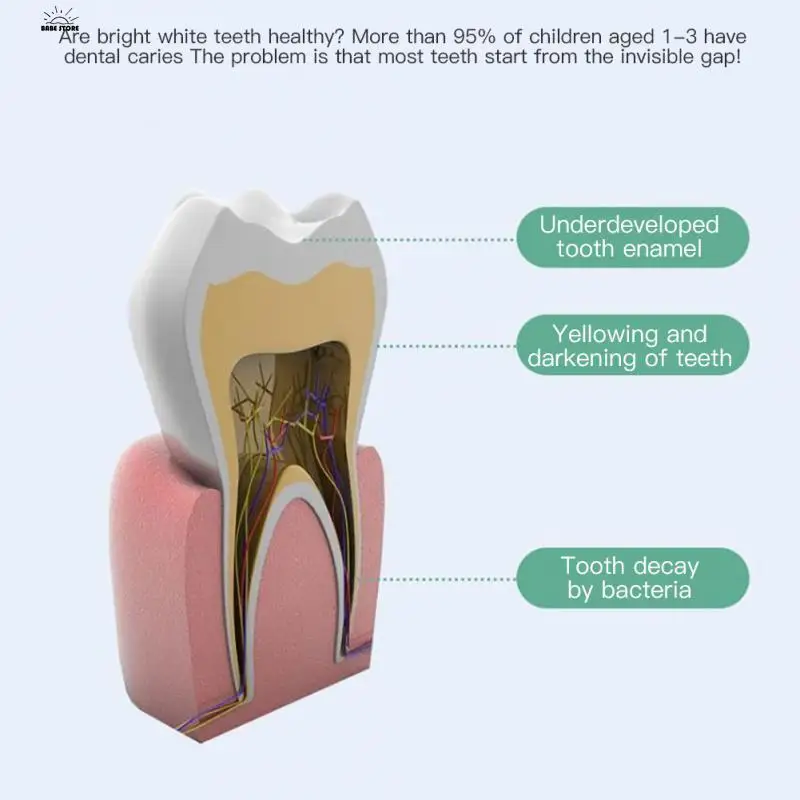 Cepillo de dientes de cerdas suaves para niños, mango grueso de color caramelo, cerdas Ultra suaves, cabeza pequeña, prevención de la caída de los dientes, nuevo cepillo de dientes