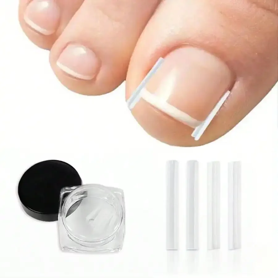 Ingrown Nail Prevention Tools, Nail Trimmers and Ingrown Nail Filling Strips, Nails Pads and Nails Trimmers Pedicure Tool