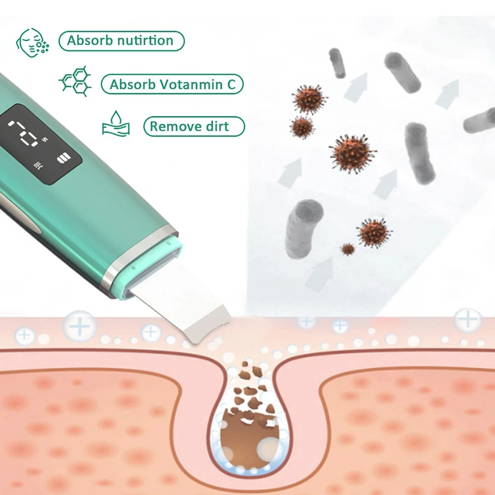 초음파 피부 스크러버 필링 블랙 헤드 리무버 딥 페이스 클리닝 초음파 이온 여드름 모공 클리너 페이셜 삽 스크러버