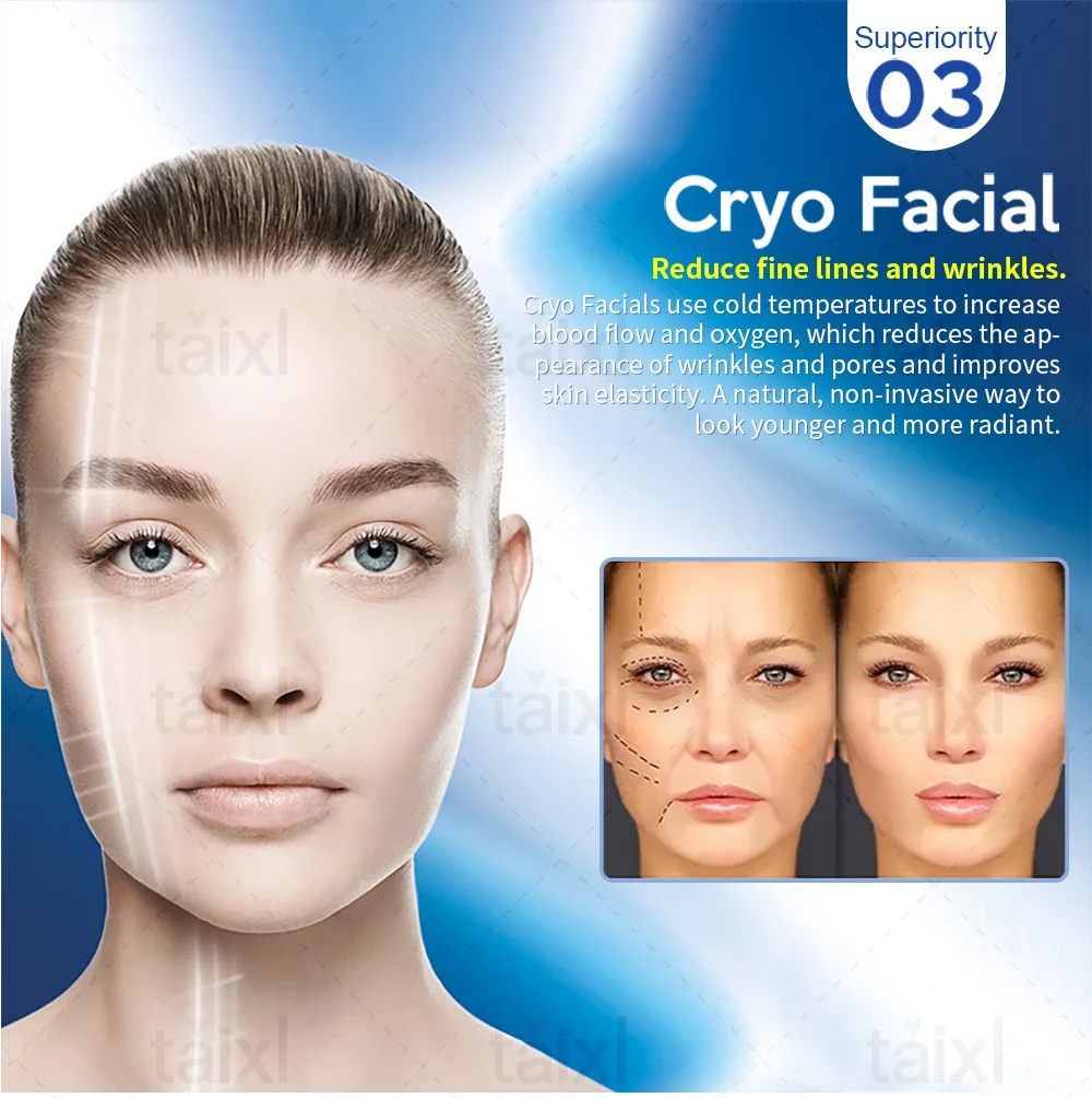

Machine PE FACE NEW needle-free Painlss RF Heat Energy Output AndStrong Pulsed Magnetic Non-invasiveFace Lift wrinkle
