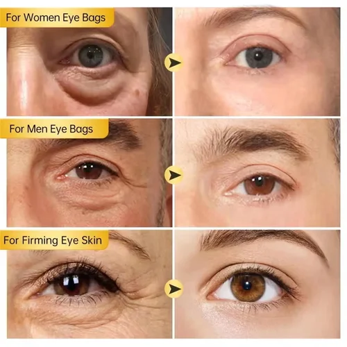 Imagen 2 del producto Crema de eliminación instantánea de bolsas de ojos, colágeno, antiarrugas, decoloración de líneas finas, reafirmante de la piel, anticírculo oscuro, hinchazón, ilumina el cuidado de los ojos