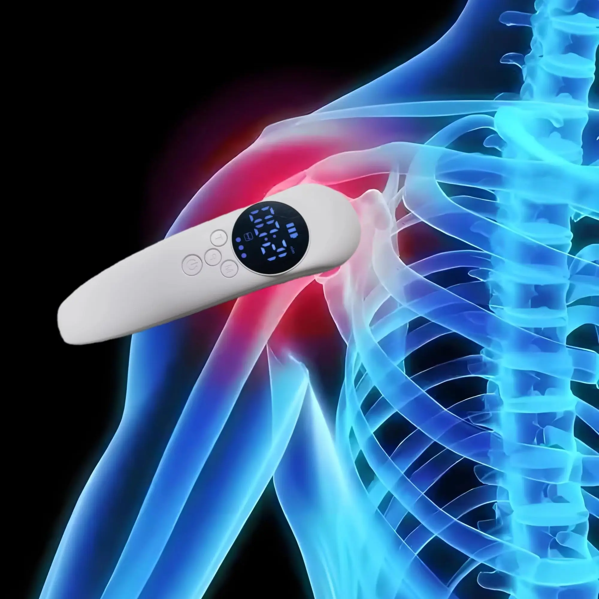 

Универсальный набор для лазерной терапии B Cure для людей и домашних животных — лечит боль в мышцах и способствует восстановлению раны домашних животных