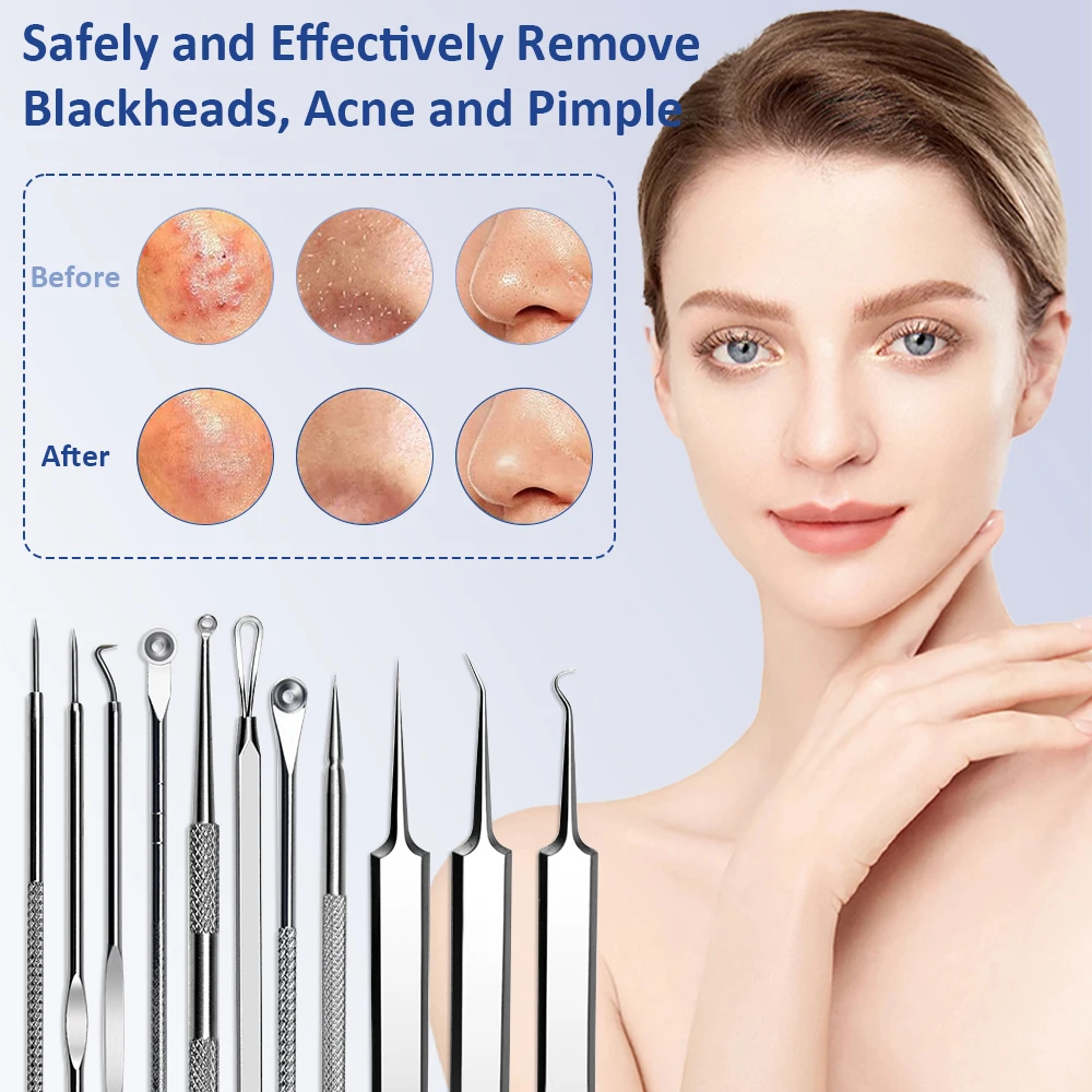 Rvs Mee-eter Removal Tool Set Acne Mee-eter Clip Pincet Stippen Porie Cleaner Acne Naald Huidreiniging Care Tools