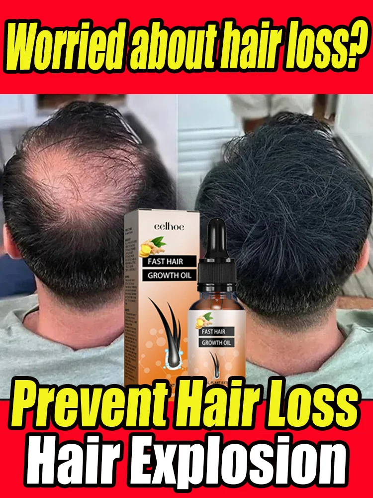 Natural Hair Growth Oil Efficient Hair Loss Nourishing Essential Oil For Dense 7 DAY Repair Damaged Hair Moisturizing Smooth Oil