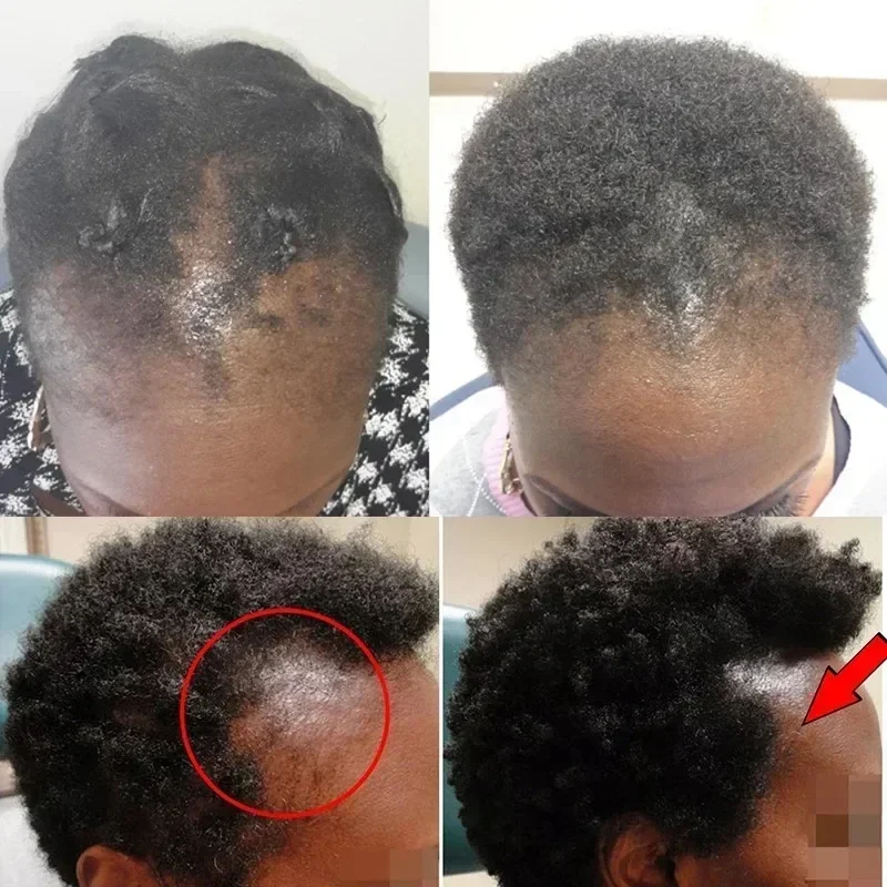 Batana Hair Growth Oil Conditioner Anti Hair Loss Products Fast Growing Hair Mask Nourishing Repair Roots Hairs Care for Women