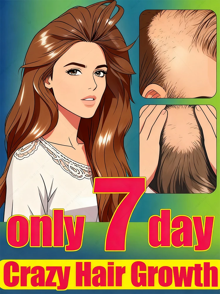 

30 days to get a frizzy sea of ​​hair, forehead, hairline and parting are all done