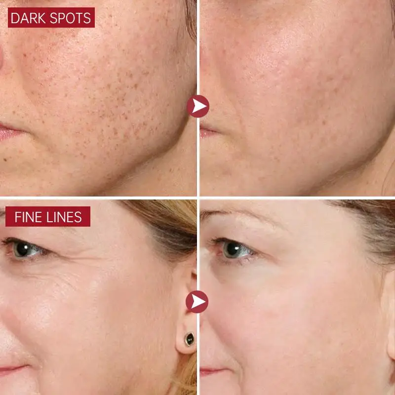 نياسيناميد كريم تبييض النمش العناية بالبشرة المستحلبات الببتيد مكافحة الشيخوخة الوجه التجاعيد كريم بقعة داكنة الميلانين إزالة