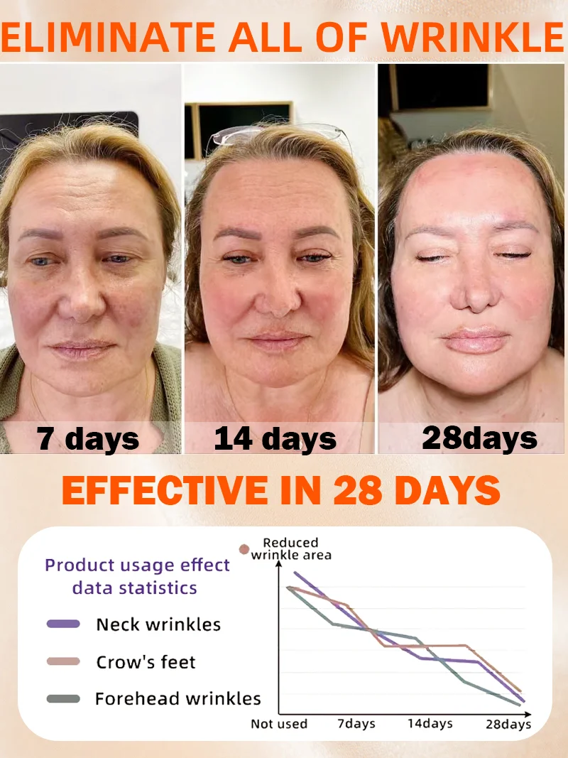 Remove restore and youthfulness wrinkles