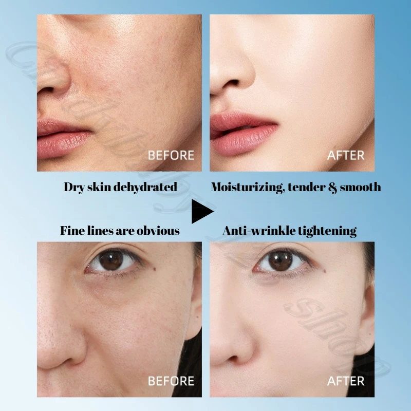 เอสเซนส์ทองคำ 24k ผสมไฮยาลูรอนนิค แอซิด ไนอะซินาไมด์ ช่วยเติมความชุ่มชื้น ลดเลือนริ้วรอย ขนาด 40 มล.