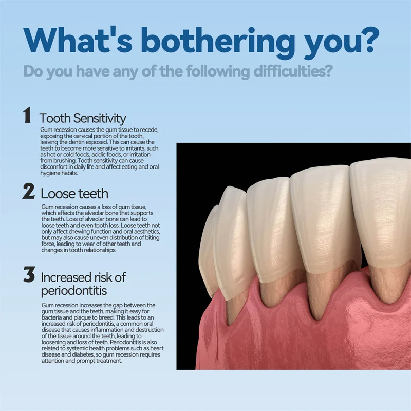 Jaysuking Gel de cuidado de encías para limpieza profunda de manchas dentales, sarro, hinchazón y dolor