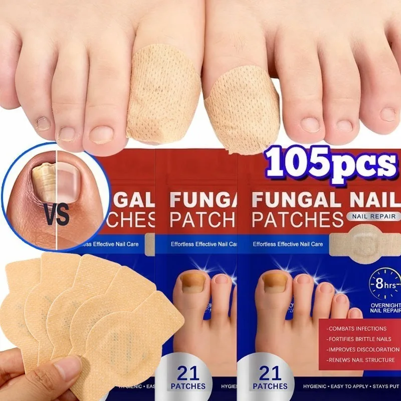 21/105 قطعة علاج فطريات الأظافر التصحيح مقاوم للماء رقعة إصلاح أظافر نام مصحح العناية بالأظافر التالفة رمادي أداة استعادة الأظافر #1