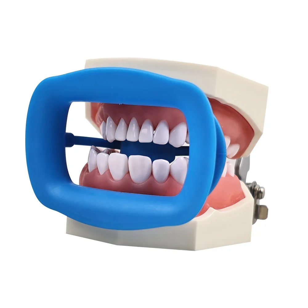 

Dental Orthodontic Mouth Opener Soft Silicon Dental Lip Cheek Retractor 3D Mouth Opener Cheek Expand Dentist Orthodontic Tools
