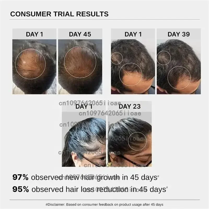 30Pflaster Haarwachstum Biotin Plus Pflaster für Frauen, Biotin Plus Polygonum Multiflorum