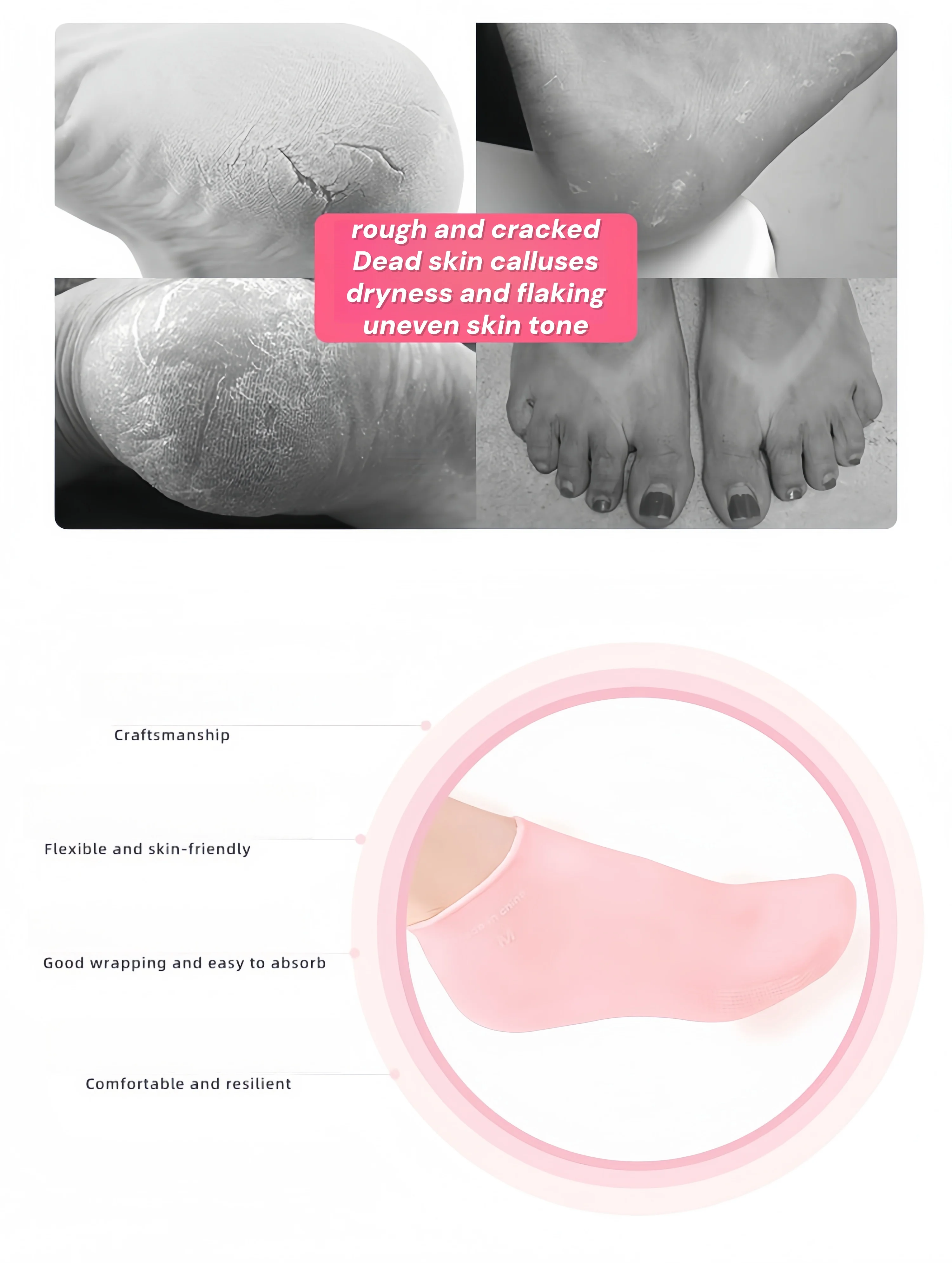 Feuchtigkeitsspendende Fußsocken, Silikonsocken für trockene, rissige Füße, Damen-Fußsocken zur Feuchtigkeitsversorgung, mit Massage – Detail 6
