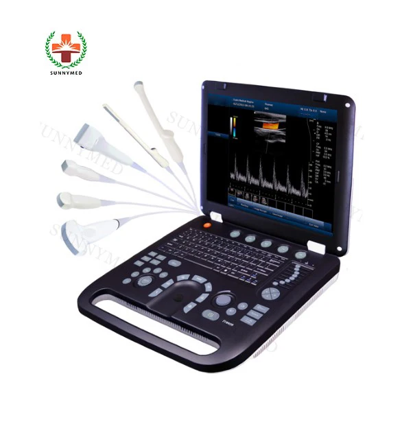 SY-A039-1 medical color doppler digital ultrasound price  human pregnancy cardiovascular laptop ultrasound scanner