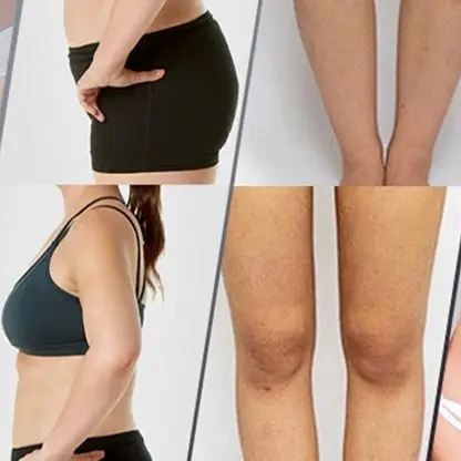 

Ручной беспроводной массажер для удаления целлюлита 4 в 1, EMS и RF радиочастотный аппарат для моделирования тела, электрический аппарат для стройного тела