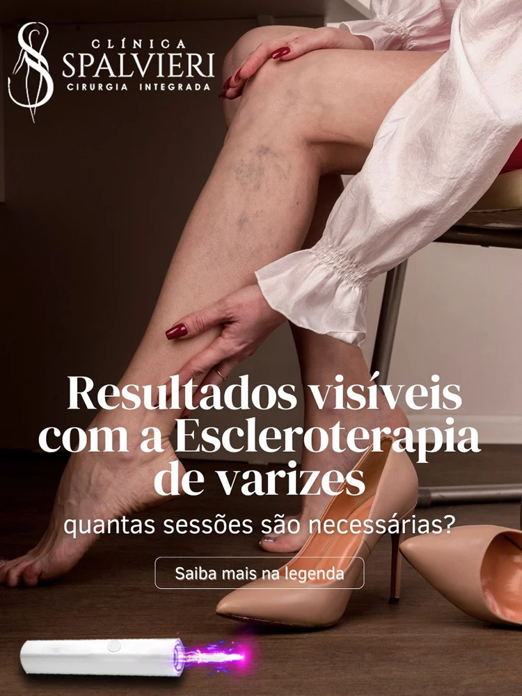 

Laser Therapy Veins Pen Leg Light Therapy For Varicose Veins Blue Light Device Skin Care