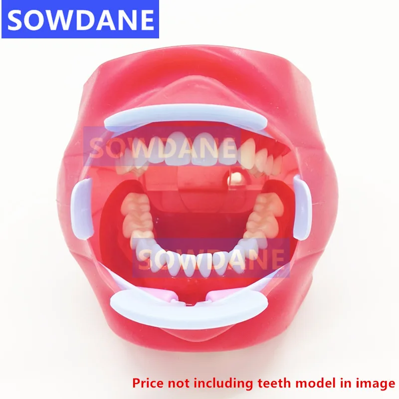 Dentes reutilizáveis branqueamento suporte para adultos, ferramenta ortodôntica dental, oral e intraoral, bochecha lábio retrator, abridor de boca, 3D