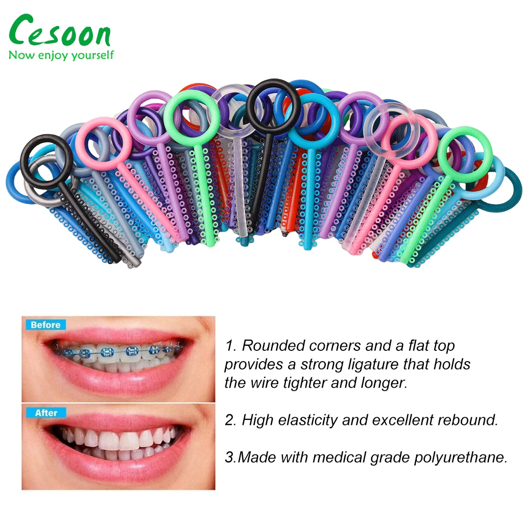 1040Pcs/40Sticks Dental Orthodontic Elastic Ligature Ties Colorful Rubber Bands for Brackets Braces Dentistry Treatment Material