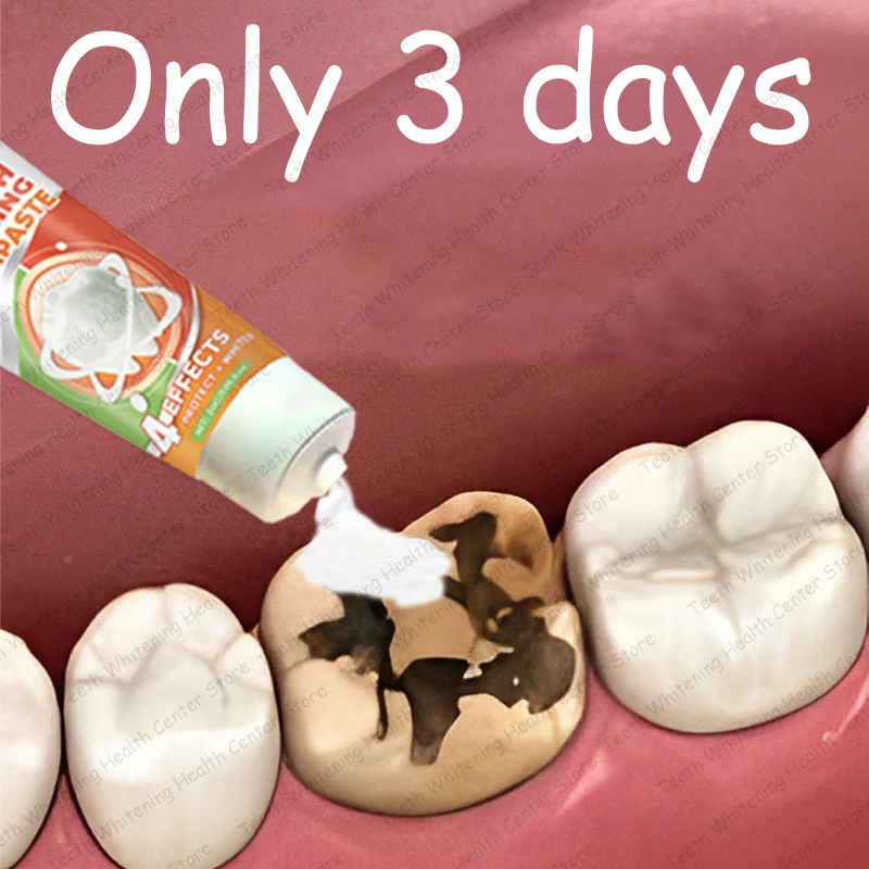 Make teeth more beautiful, ᴅᴇᴇᴘʟʏ ʀᴇᴘᴀɪʀ ᴏʀᴀʟ ᴄᴀᴠɪᴛʏ ᴄᴀʀᴇ