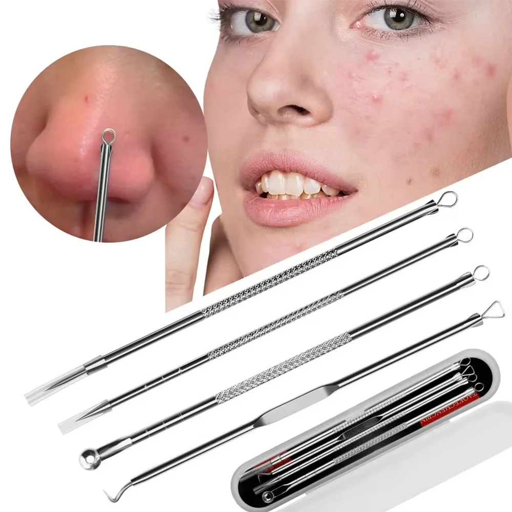 Set da 4 pezzi di aghi per la rimozione dell'acne, set di aghi per l'acne ultrafine, rimozione dei punti neri, spremitura e strumento per la pulizia
