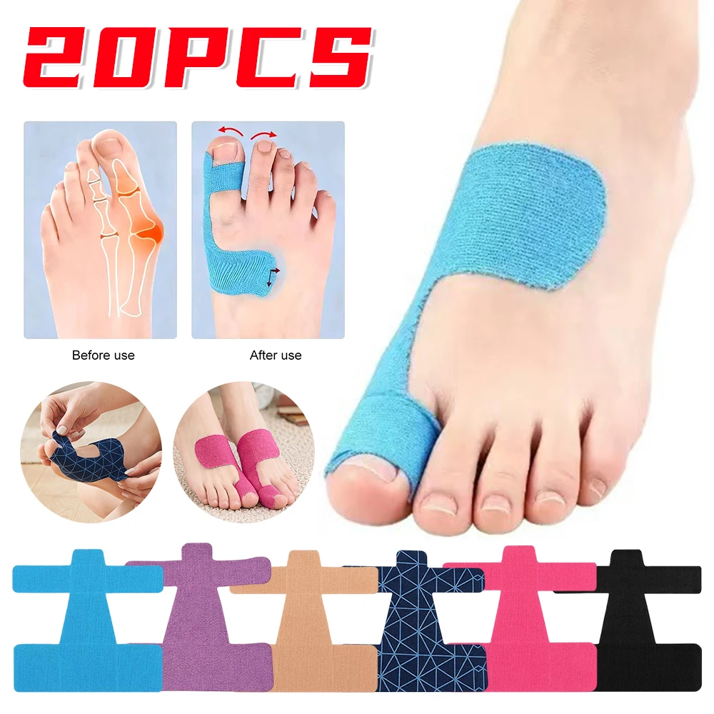 20 separadores de dedos, soporte fijo para hallux valgus, correa ortopédica para juanetes, parche protector antifricción para la corrección del dedo gordo del pie