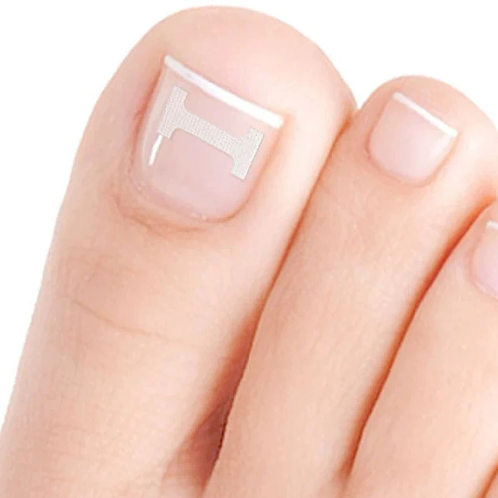

10 Pcs Ingrown Toenail Patch Breathable Correction Tape Corrector Stickers Invisible