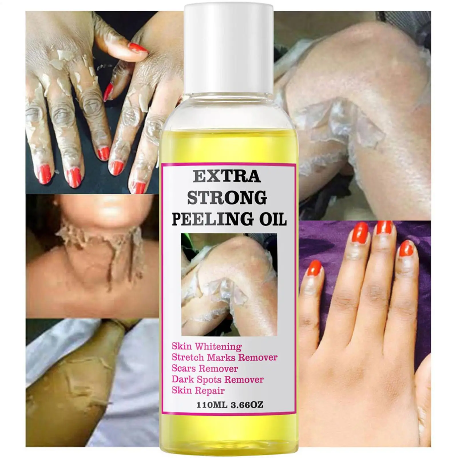 Exfoliating Yellow Skin Oil For Body Skin Moisturizing Nourishing Brightening Firming Moisturizing Massage Beauty Care Oil 110ml