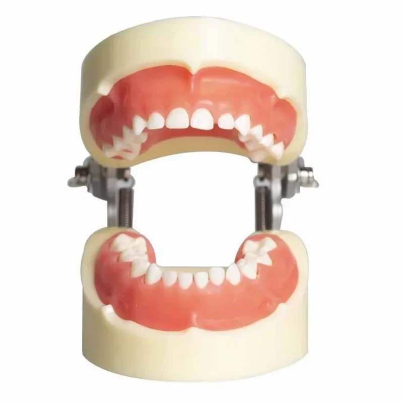 Children's Deciduous Tooth Model Removable Caries Model Children's Dental Caries Grain Oral Teaching Demonstration Dental Model