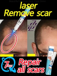 Laser repair of skin scars