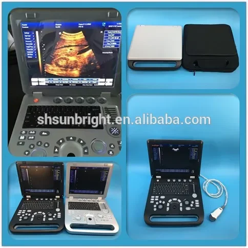 Sunbright cheap SUN-800D1 laptop ultrasound system portable ultrasonics diagnostic device