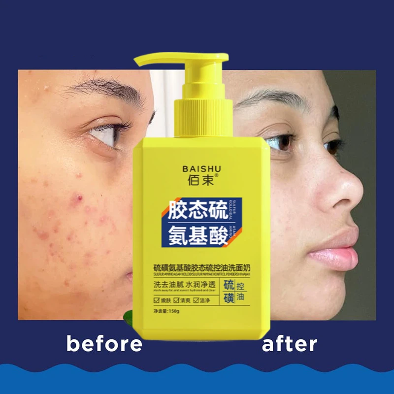 Sulfur Amino Acid Oil Control Facial Cleanser 150g Gentle Cleansing Hydrating Moisturizing Not Tight