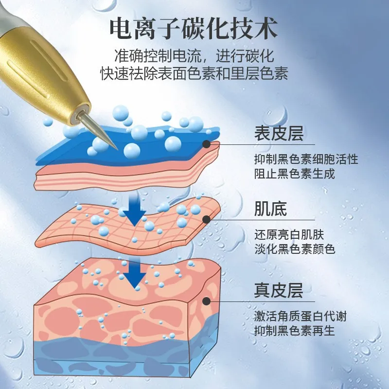 Dispositivo di rimozione delle lentiggini non invasivo con tecnologia nera 5G8G, talpa, scansione delle macchie facciali e pori, onda magnetica speciale