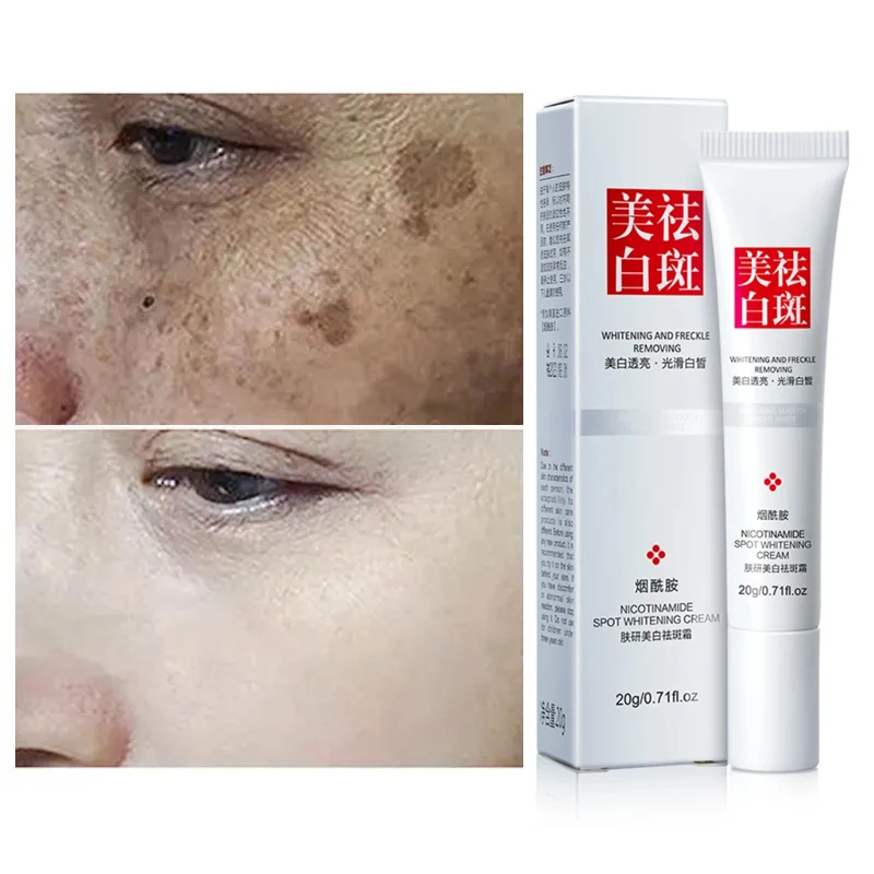 Crème blanchissante efficace pour éclaircir le visage, éliminer les taches, les taches brunes, le mélasma, lutter contre la pigmentation, améliorer la teint terne, soin de la peau du visage 1