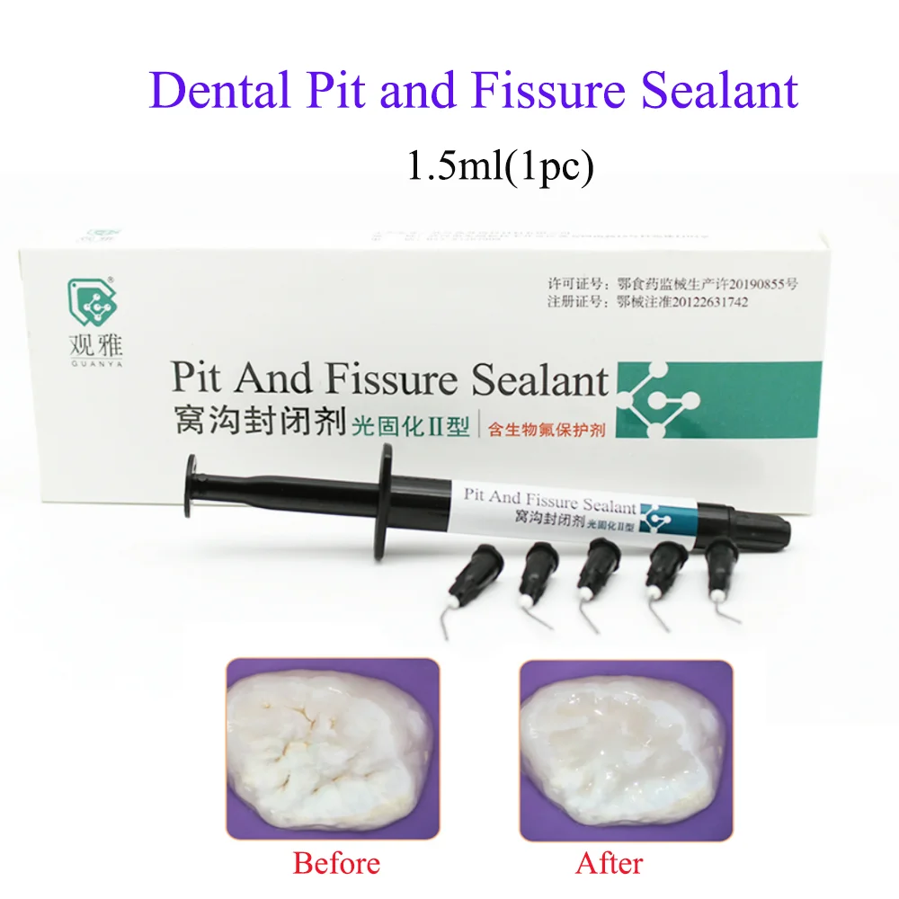 Pit and fissure sealant light-curing type containing biological fluorine protective agent  dental materials for dental clinic